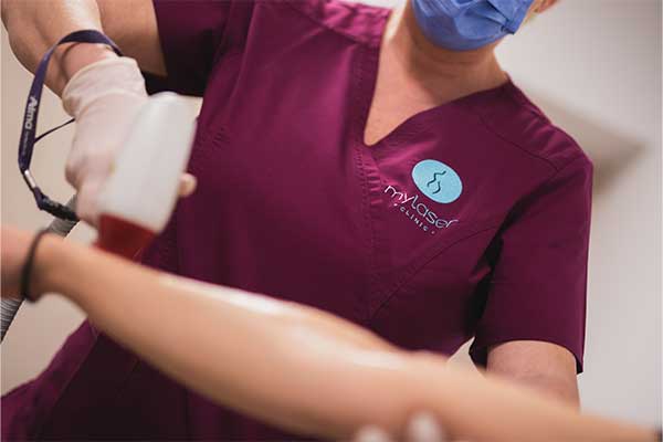 ΔΙΟΔΙΚΟ ΛΕΙΖΕΡ 15 ΑΠΟΤΡΙΧΩΣΗ ΜΕ ΔΙΟΔΙΚΟ LASER